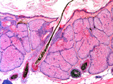 Case 8, Fig. 6