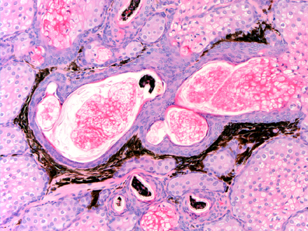 Case #8, Fig. 7