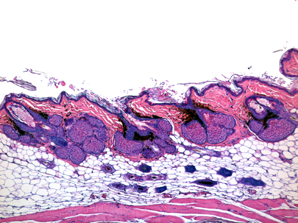 Case #8, Fig. 8b