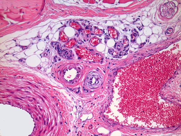 Case #9, Fig. 2