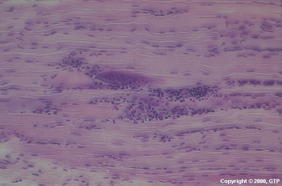 Case # 2, Fig. 2