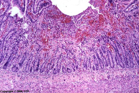 Case # 3, Fig. 1