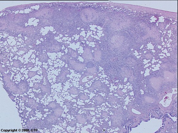 Case # 7, Fig. 1