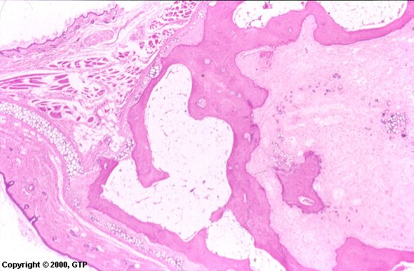 Case # 10, Fig. 1