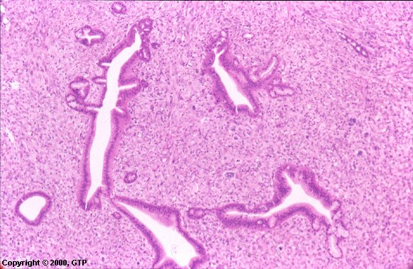 Case # 14, Fig. 1