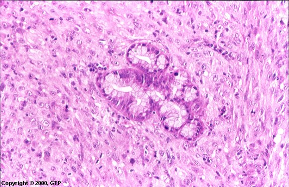 Case # 14, Fig. 2