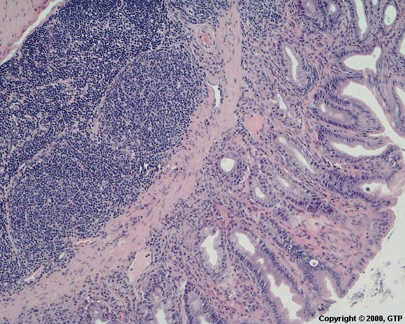 Case # 16, Fig. 1