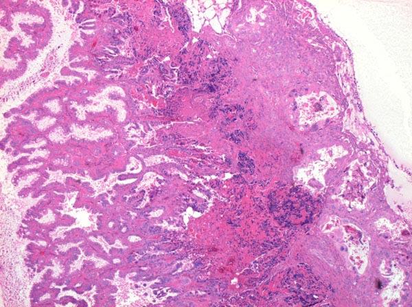 Case # 4, Fig. 2