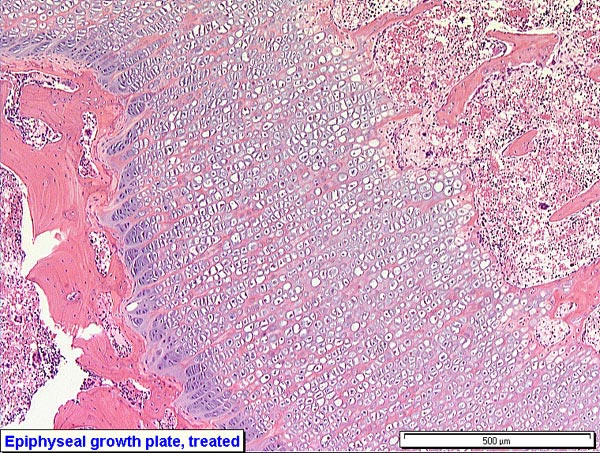 Case # 5, Fig. 2