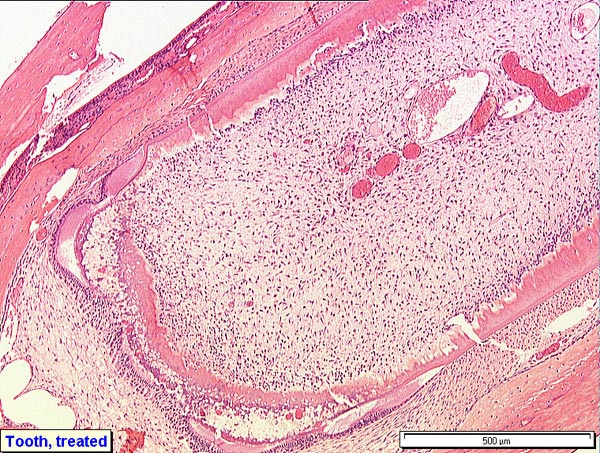 Case # 5, Fig. 4