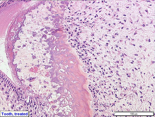 Case # 5, Fig. 5