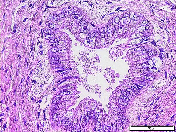 Case # 8, Fig. 1