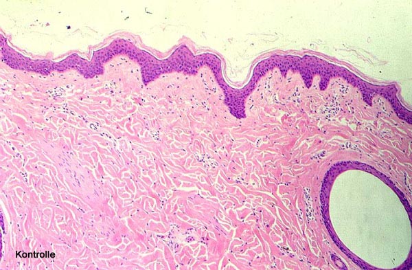 Case # 16, Fig. 1