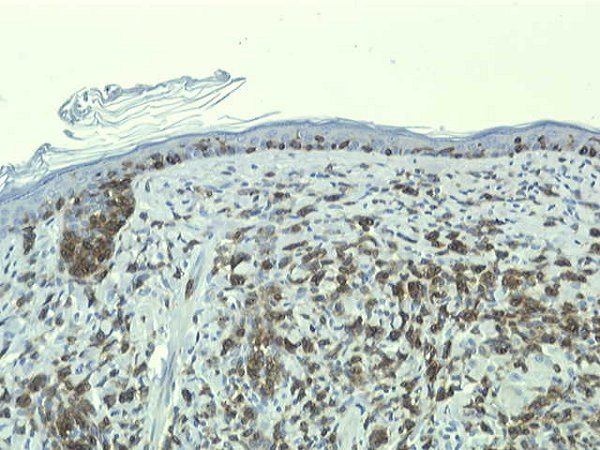 Case # 3, Fig. 4