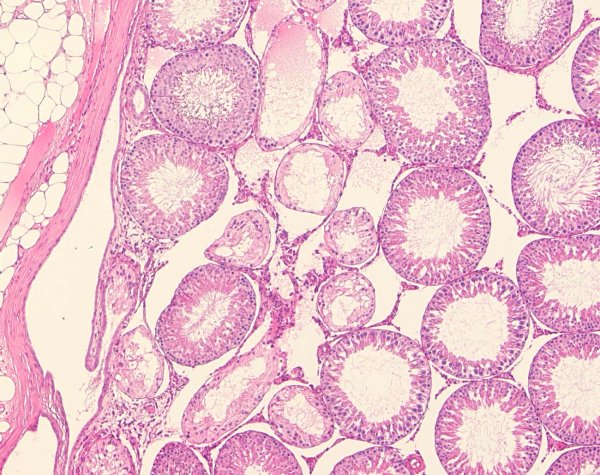 Case # 6, Fig. 1