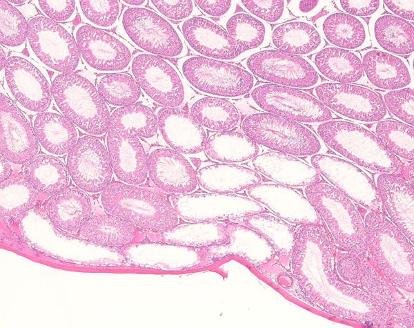 Case # 6, Fig. 4