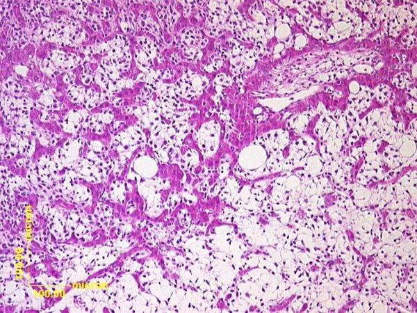 Case # 12, Fig. 1