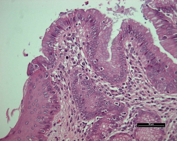 Case # 14, Fig. 3