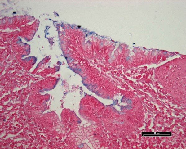 Case # 14, Fig. 4