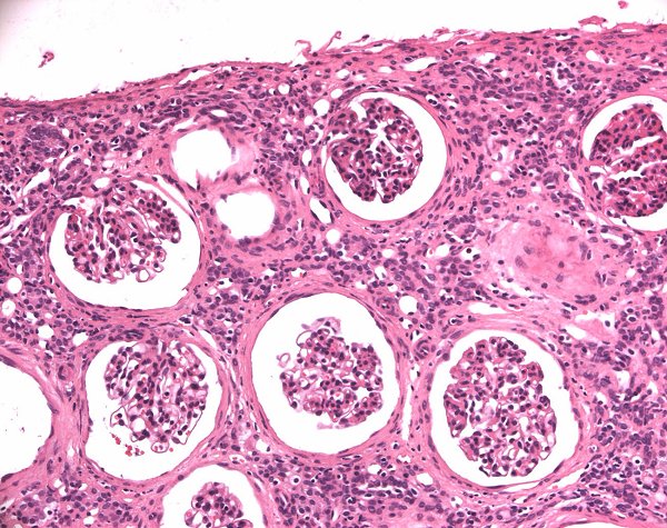 Case # 17, Fig. 1