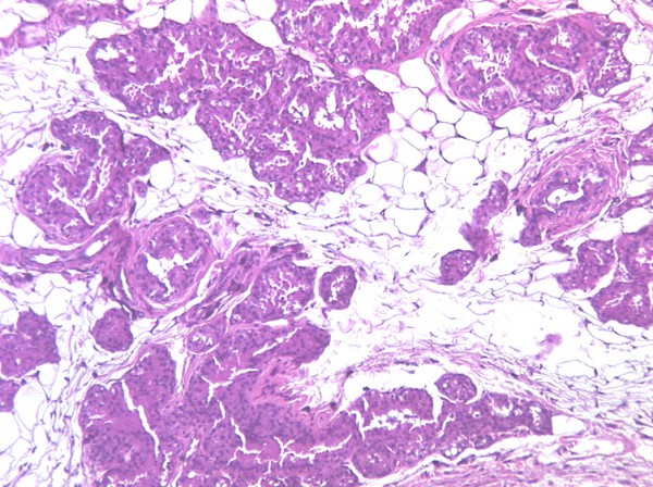 Case # 3, Fig. 1 control