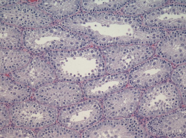 Case # 6, Fig. 2 (6b)