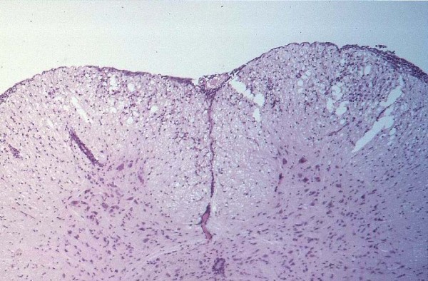 Case # 8, Fig. 1