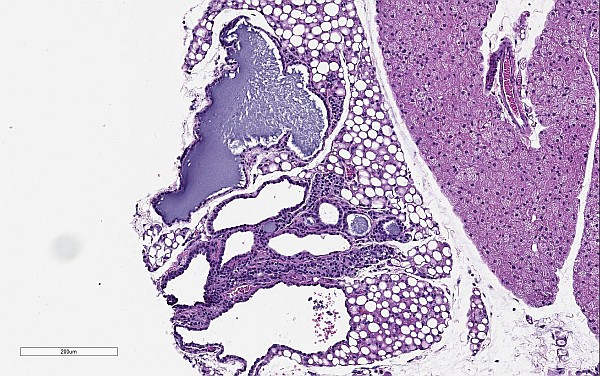 Case No 1, Fig. 2