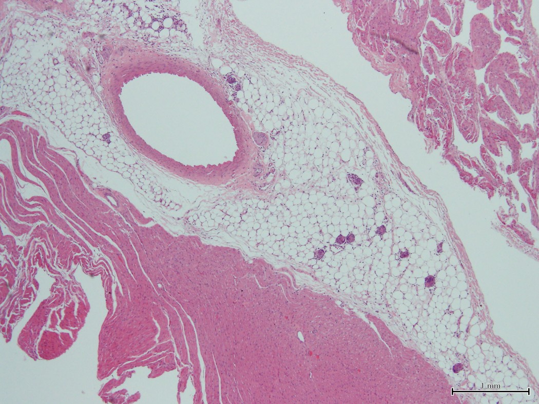 Case No 2, Fig. 1