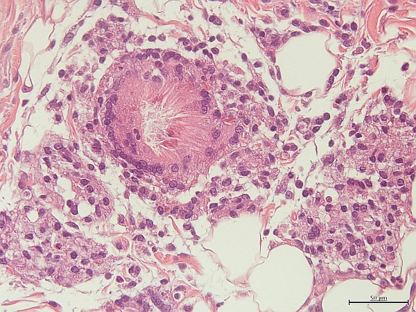 Case No 2, Fig. 2