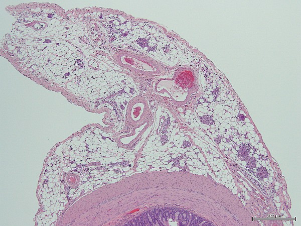 Case No 2, Fig. 3