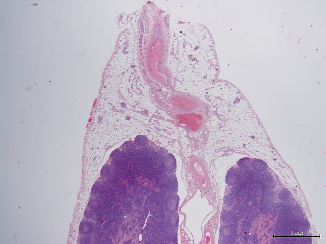 Case No 2, Fig. 4