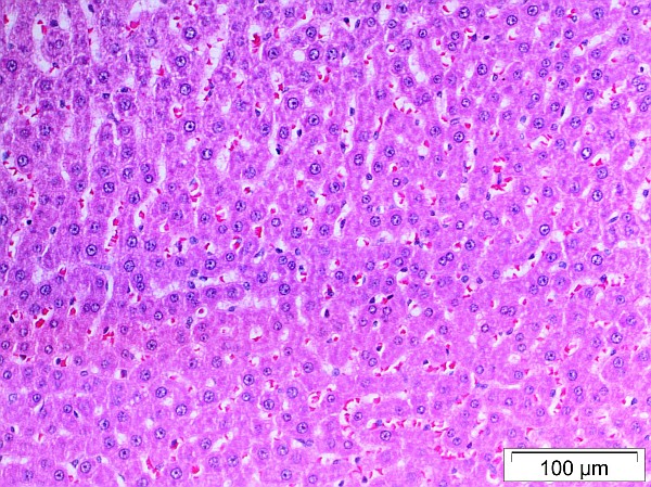 Case No 4, Fig. 2