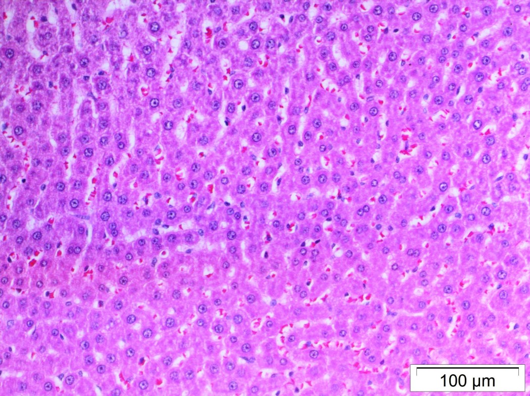 Case No 4, Fig. 2