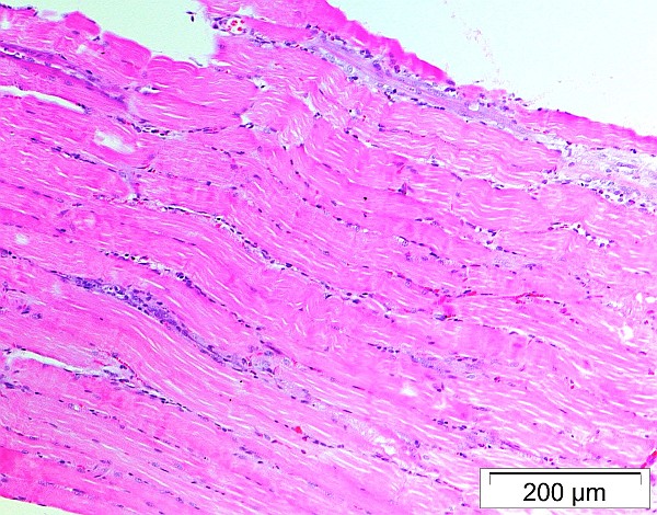 Case No 4, Fig. 3